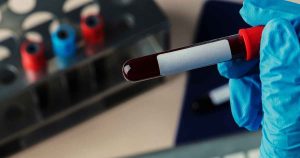 Coleta de sangue automatizada usa robô que acerta veia em quase 100% dos casos